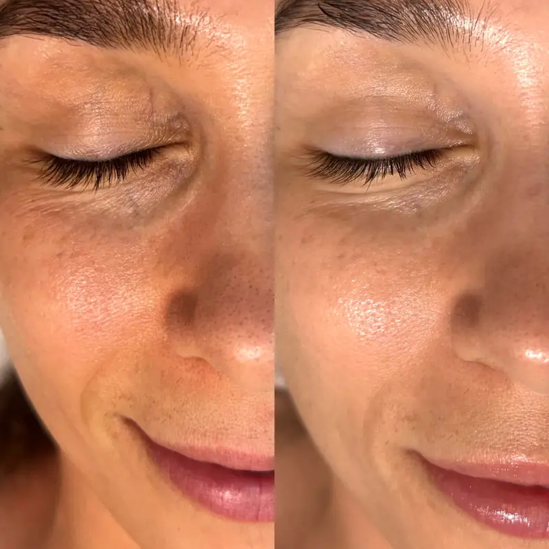 Before and after a facial at Tulum Spa by Tomo in Los Angeles